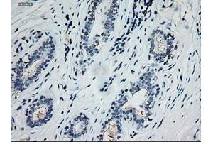Immunohistochemical staining of paraffin-embedded breast using anti-EpCAM (ABIN2452677) mouse monoclonal antibody. (EpCAM antibody  (AA 24-265))