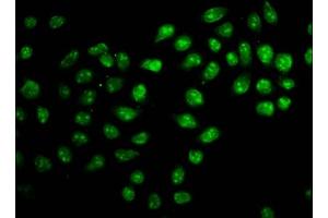 Immunofluorescence staining of Hela cells with ABIN7176167 at 1:166, counter-stained with DAPI. (ZNF224 antibody  (AA 477-607))