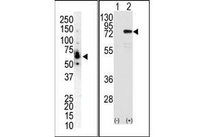 (LEFT)Western blot analysis of anti-PKC eta N-term Pab in NCI-H460 cell lysate.