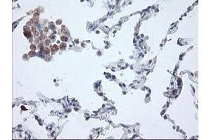 Image no. 12 for anti-Amyloid beta (A4) Precursor Protein (APP) antibody (ABIN1496885) (APP antibody)