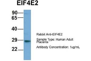 Host: Rabbit  Target Name: EIF4E2  Sample Tissue: Human Adult Placenta  Antibody Dilution: 1.