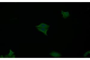 Detection of CASP7 in Human MCF7 cell using Polyclonal Antibody to Caspase 7 (CASP7) (Caspase 7 antibody  (AA 207-303))