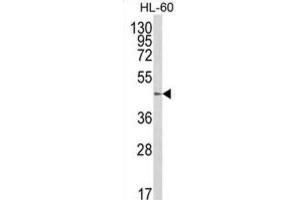 Western Blotting (WB) image for anti-UDP-Gal:betaGlcNAc beta 1,4 Galactosyltransferase, Polypeptide 1 (B4GALT1) antibody (ABIN3003951) (B4GALT1 antibody)