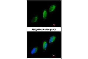 ICC/IF Image Immunofluorescence analysis of paraformaldehyde-fixed HeLa, using TYK2, antibody at 1:200 dilution. (TYK2 antibody)