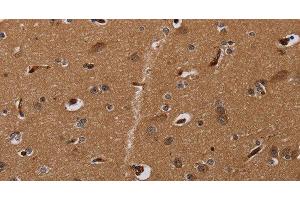 Immunohistochemistry of paraffin-embedded Human brain using MOB1A Polyclonal Antibody at dilution of 1:30 (MOB1A antibody)