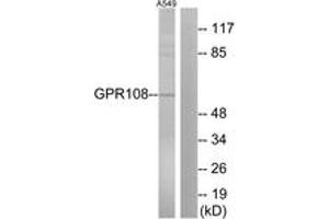 Western blot analysis of extracts from A549 cells, using GPR108 Antibody. (GPR108 antibody  (AA 155-204))