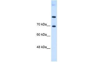 WB Suggested Anti-SLC7A4 Antibody Titration:  0.