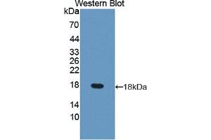 Western blot analysis of the recombinant protein. (DUSP5 antibody  (AA 1-135))