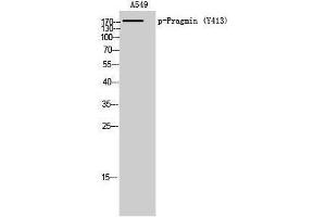 Western Blotting (WB) image for anti-Tyrosine-Protein Kinase SgK223 (SGK223) (pTyr413) antibody (ABIN3172968) (PRAGMIN antibody  (pTyr413))