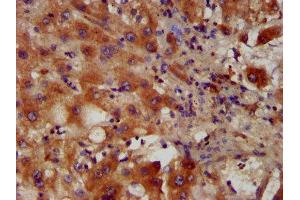 IHC image of ABIN7163270 diluted at 1:400 and staining in paraffin-embedded human liver tissue performed on a Leica BondTM system.