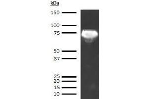 Western Blotting (WB) image for anti-alpha-Fetoprotein (AFP) antibody (ABIN613541) (alpha Fetoprotein antibody)
