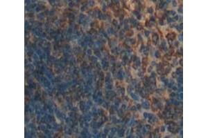Used in DAB staining on fromalin fixed paraffin- embedded Kidney tissue (DC-SIGN/CD209 antibody  (AA 115-238))