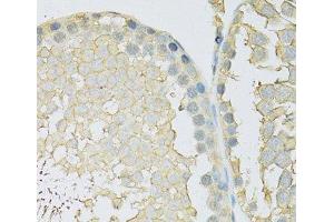 Immunohistochemistry of paraffin-embedded Rat testis using SLC2A9 Polyclonal Antibody at dilution of 1:100 (40x lens). (SLC2A9 antibody)