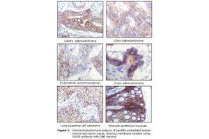 Image no. 1 for anti-Insulin-Like Growth Factor 1 Receptor (IGF1R) antibody (ABIN232138) (IGF1R antibody)