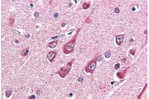 Human Brain, Cortex (formalin-fixed, paraffin-embedded) stained with OGT antibody ABIN337257 at 5 ug/ml followed by biotinylated anti-goat IgG secondary antibody ABIN481715, alkaline phosphatase-streptavidin and chromogen. (OGT antibody  (AA 543-555))