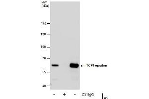 Immunoprecipitation (IP) image for anti-Chaperonin Containing TCP1, Subunit 5 (Epsilon) (CCT5) antibody (ABIN2856739)