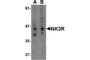 Western Blotting (WB) image for anti-Tachykinin Receptor 3 (TACR3) (Middle Region) antibody (ABIN1031019) (TACR3 antibody  (Middle Region))