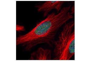 ICC/IF Image Confocal immunofluorescence analysis (Olympus FV10i) of paraformaldehyde-fixed HeLa, using ZNF38, antibody (Green) at 1:500 dilution. (ZSCAN21 antibody)