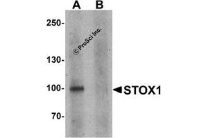 Western Blotting (WB) image for anti-Storkhead Box 1 (STOX1) (C-Term) antibody (ABIN1030709)