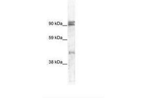 Image no. 1 for anti-Zinc Finger Protein 227 (ZNF227) (AA 118-167) antibody (ABIN6736006)