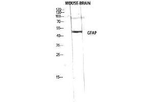Western Blotting (WB) image for anti-Glial Fibrillary Acidic Protein (GFAP) (Ser423) antibody (ABIN3180065) (GFAP antibody  (Ser423))