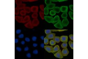 ABIN6257034 and ABIN6275778 staining Hela cells(30 min of UV treatment) by IF/ICC. (KRT37,38 (C-Term) antibody)