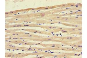 Immunohistochemistry of paraffin-embedded human heart tissue using ABIN7151354 at dilution of 1:100