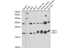 Western blot analysis of extracts of various cell lines, using RPL11 antibody (ABIN6129101, ABIN6147106, ABIN6147108 and ABIN6222040) at 1:1000 dilution. (RPL11 antibody  (AA 1-177))