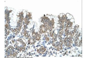 Immunohistochemistry (IHC) image for anti-Salt-Inducible Kinase 1 (SIK1) (N-Term) antibody (ABIN310741) (SIK1 antibody  (N-Term))