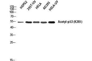 Western Blot (WB) analysis of HepG2 293T-UV HeLa AD293 HeLa-UV using Acetyl-p53 (K381) Polyclonal Antibody. (p53 antibody  (acLys381))