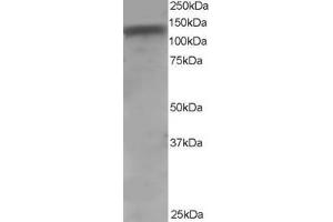 (ABIN184721) staining (0. (ADAM17 antibody  (C-Term))