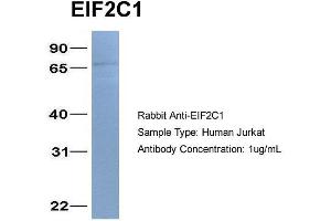 Host: Rabbit Target Name: EIF2C1 Sample Type: Jurkat Antibody Dilution: 1.