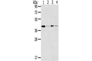 Gel: 8 % SDS-PAGE,Lysate: 40 μg,Lane 1-4: 293T cells, K562 cells, Lovo cells, Human bladder carcinoma tissue,Primary antibody: ABIN7191340(MAGEA11 Antibody) at dilution 1/200 dilution,Secondary antibody: Goat anti rabbit IgG at 1/8000 dilution,Exposure time: 30 seconds (MAGEA11 antibody)