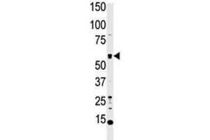Western blot analysis of MST1 antibody and HL-60 cell lysate. (STK4 antibody  (AA 385-415))