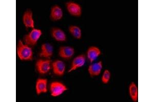 Immunofluorescent analysis of A549 cells using ABIN7152690 at dilution of 1:100 and Cy3-congugated Goat Anti-Rabbit IgG (FARP1 antibody  (AA 1-300))