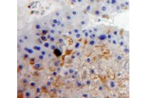 Used in DAB staining on fromalin fixed paraffin-embedded Liver tissue (CD11c antibody  (AA 143-344))