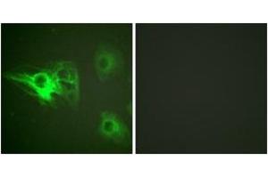 Immunofluorescence analysis of HeLa cells, using Keratin 8 (Phospho-Ser432) Antibody. (KRT8 antibody  (pSer432))