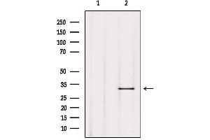 Western blot analysis of extracts from Mouse lung, using TRIO Antibody.
