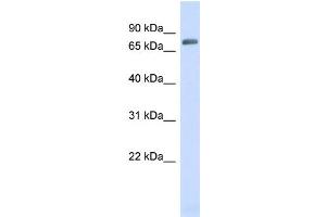WB Suggested Anti-TRIM41 Antibody Titration:  0. (TRIM41 antibody  (N-Term))