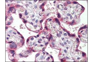 Immunohistochemistry (Paraffin-embedded Sections) (IHC (p)) image for anti-Chemokine (C-C Motif) Receptor 4 (CCR4) (Extracellular Domain) antibody (ABIN615457)