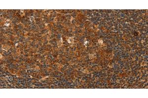 Immunohistochemistry of paraffin-embedded Human tonsil using HDAC8 Polyclonal Antibody at dilution of 1:40 (HDAC8 antibody)
