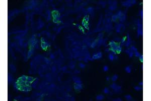 Image no. 1 for anti-Keratin 7 (KRT7) antibody (ABIN335336) (Cytokeratin 7 antibody)