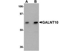 Western Blotting (WB) image for anti-UDP-N-Acetyl-alpha-D-Galactosamine:polypeptide N-Acetylgalactosaminyltransferase 10 (GalNAc-T10) (GALNT10) (C-Term) antibody (ABIN1030404) (GALNT10 antibody  (C-Term))