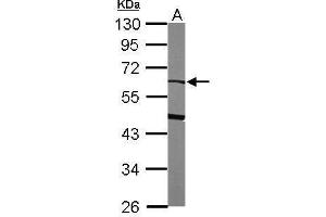 WB Image Sample (50 ug of whole cell lysate) A: mouse liver 10% SDS PAGE antibody diluted at 1:1000 (alpha 2 Antiplasmin antibody  (Center))