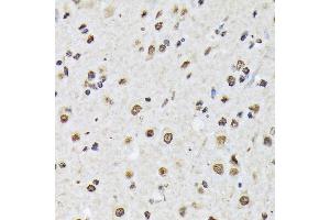 Immunohistochemistry of paraffin-embedded mouse spinal cord using Matrin 3 Rabbit mAb (ABIN7268414) at dilution of 1:100 (40x lens). (MATR3 antibody)