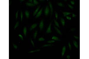 Immunofluorescence staining of Hela Cells with ABIN7127607 at 1:50, counter-stained with DAPI. (Recombinant MAD2L2 antibody)