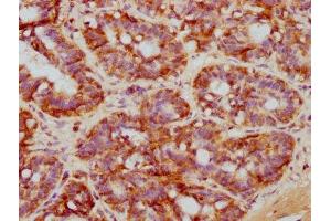 IHC image of ABIN7127637 diluted at 1:71. (Recombinant NDRG1 antibody)