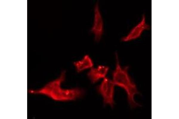 OR4C15 antibody  (C-Term)