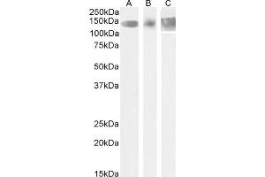 Western Blotting (WB) image for anti-Leptin Receptor (LEPR) (Internal Region) antibody (ABIN185639)