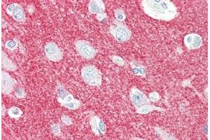 Human Brain, Cortex (formalin-fixed, paraffin-embedded) stained with CRMP1 antibody ABIN461920 at 5 ug/ml followed by biotinylated goat anti-rabbit IgG secondary antibody ABIN481713, alkaline phosphatase-streptavidin and chromogen. (CRMP1 antibody  (N-Term))